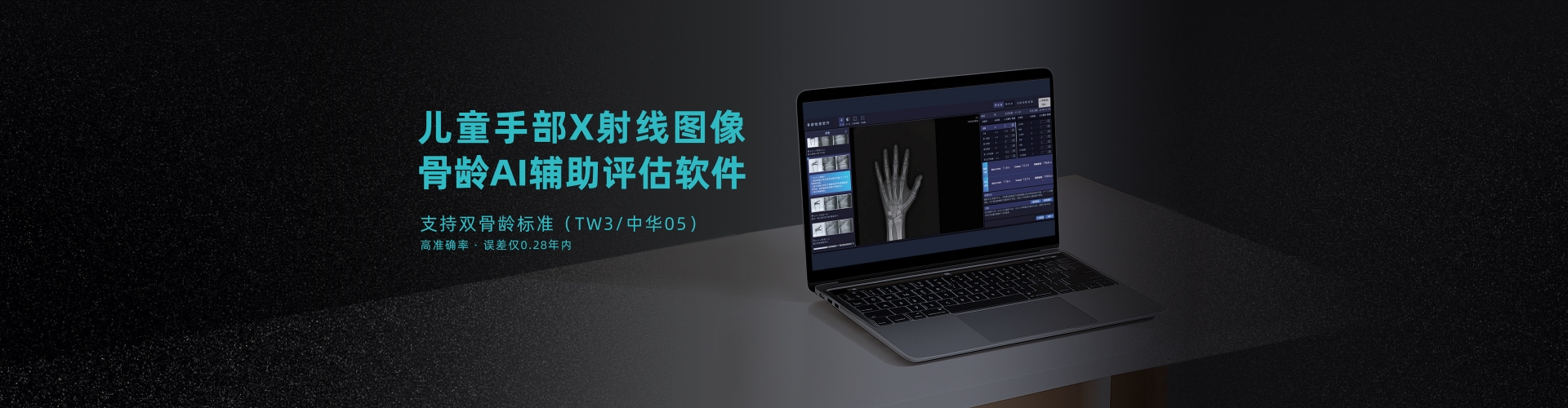 骨龄AI评估软件 骨龄AI评估软件
